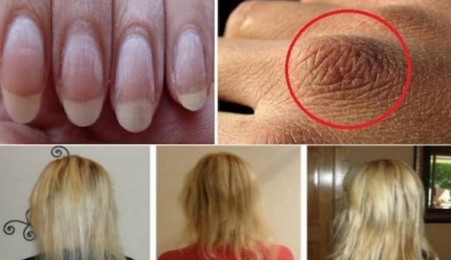 لعلاج تساقط الشعر وجفاف الجلد والاظافر، عليك بـ...