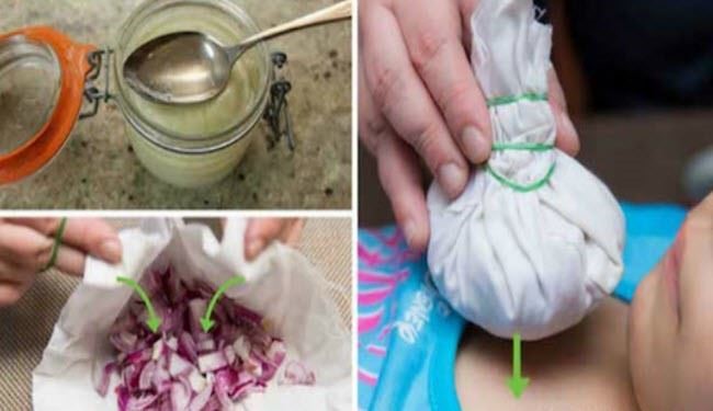 پیاز بخورید؛ دکتر نروید!