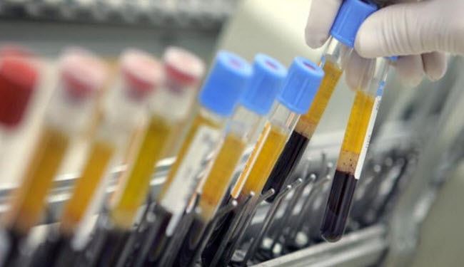 واخيراً.. اختبار دم يحذرك من أمراض القلب