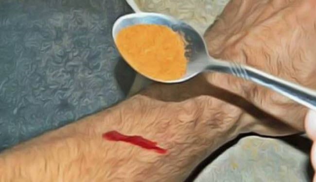 وصفة طبيعية.. كيف توقفون النزيف في 15 ثانية فقط ؟