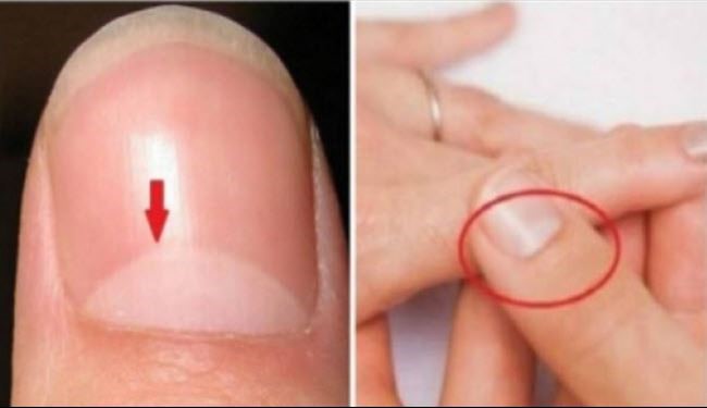 هل تعلمون ما هي فائدة هذه الدائرة على ظفركم؟