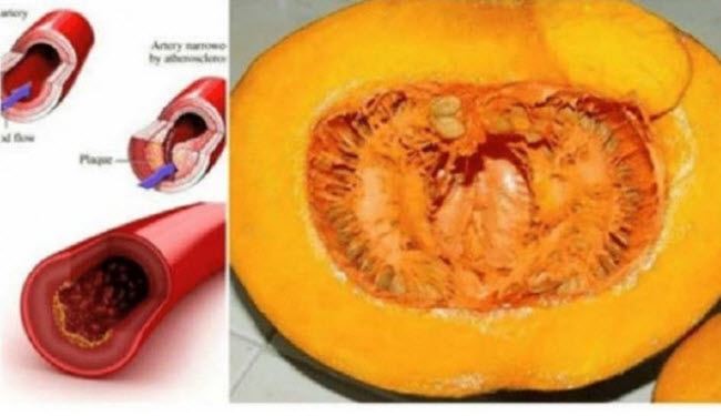 نظفوا دمكم من السموم خلال شهر بواسطة هذا العصير فقط!