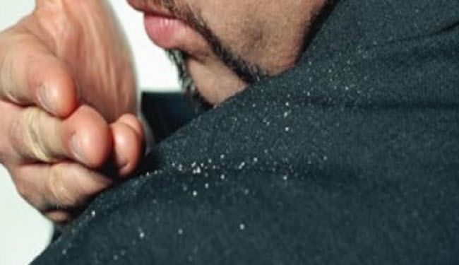 وصفة سهلة للتخلص من قشرة الشعر نهائيا وبدون تكلفة