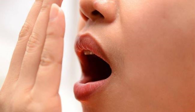 دراسة جديدة..إليكم سبب رائحة الفم الكريهة والحلول