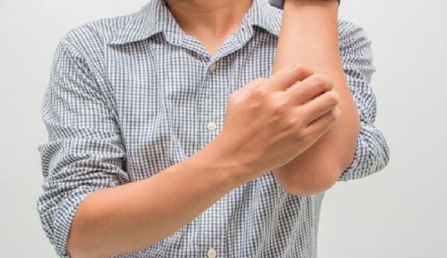 البعوض يزعجك؟ تجنب لسع الحشرات بطرق بسيطة