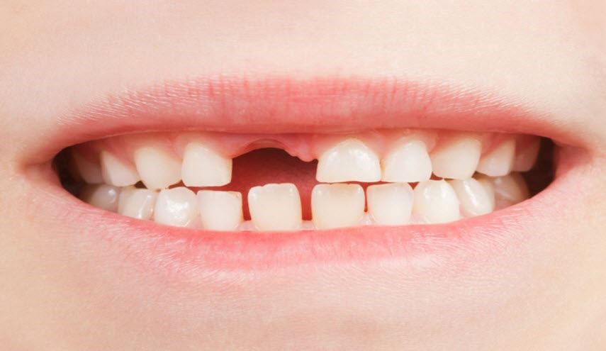 لا تتخلص من الأسنان التي يفقدها ابنك الصغير بعد الأن!