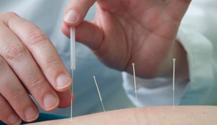متخصص طب سوزنی با دیدن زبانتان چه می فهمد؟