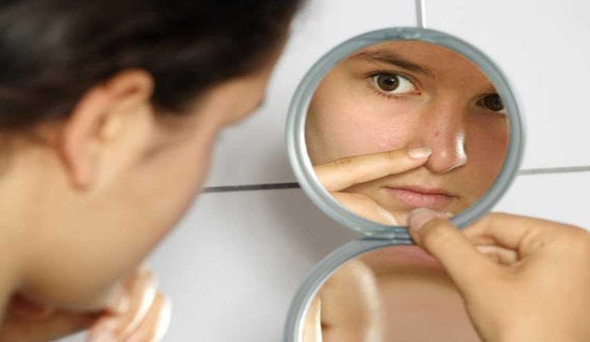 للقضاء على البثور السوداء .. طبّقوا هذه الوصفات الطبيعية المُذهلة
