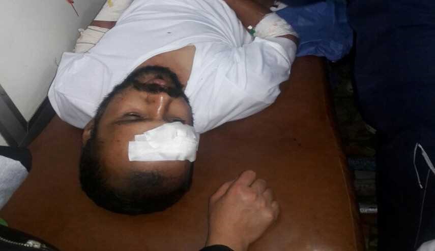 بالصور.. شهداء وجرحى باعتداءات ارهابية على حلب
