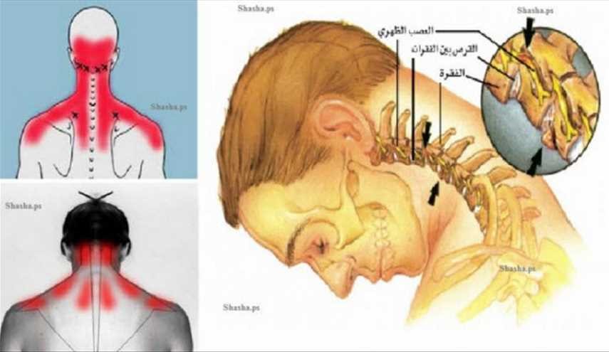 هذه العادة التي تقوم بها كل يوم هي السبب في أوجاع رقبتك!
