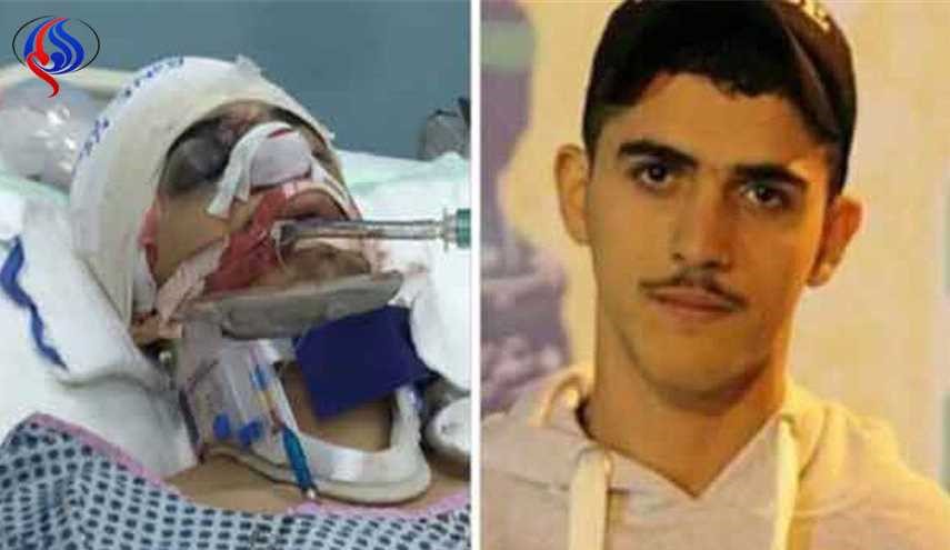 النظام البحريني يتنصّل من هجومه الدموي على معتصمي الدراز