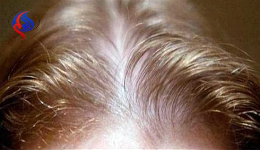وصفة الثوم وحلاقة الشعر أهم طرق طبيعية لنموه سريعاً
