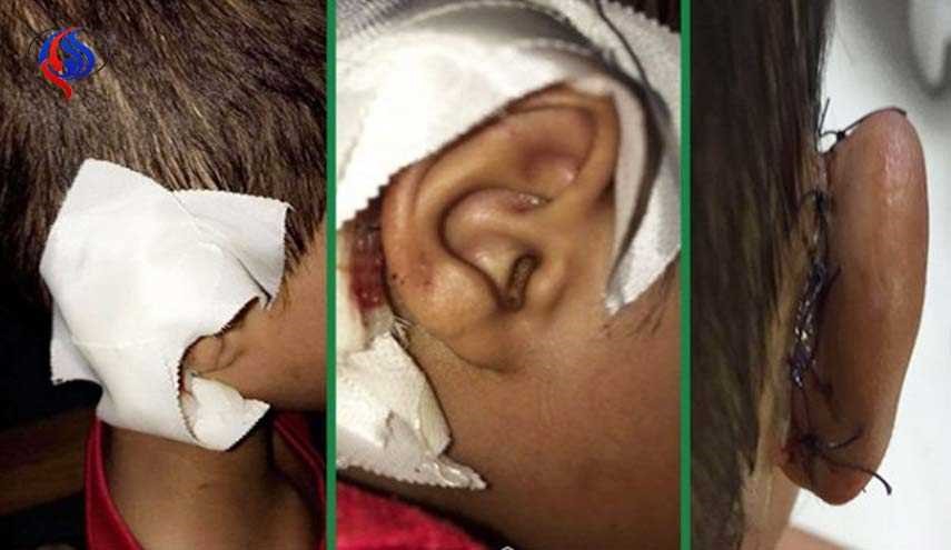 المعلم السعودي الذي قطع أذن تلميذه يستبق الاحداث ويعلن عن مفاجأة!