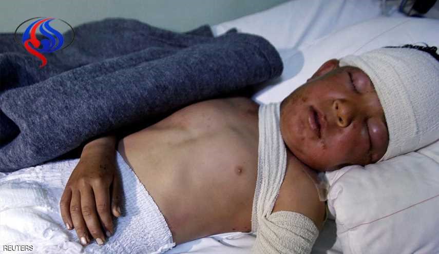 العراق: لا دليل على هجمات بأسلحة كيماوية في الموصل