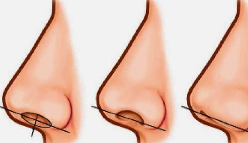 حجم فتحة الأنف لدى الانسان يدل على...؟