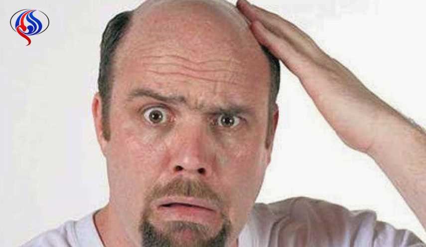 دراسة..هذه هي صفات الرجال المعرضين للصلع المبكر