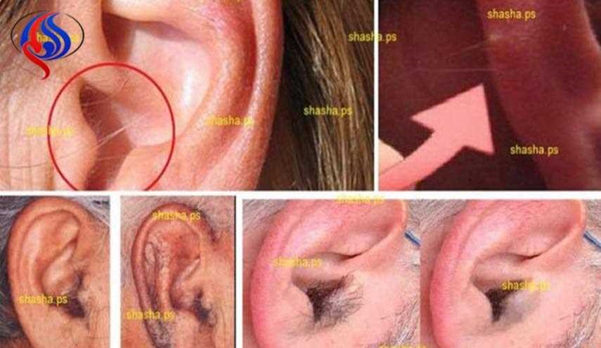 هام جداً.. هل لديك شعر على أذنك؟
