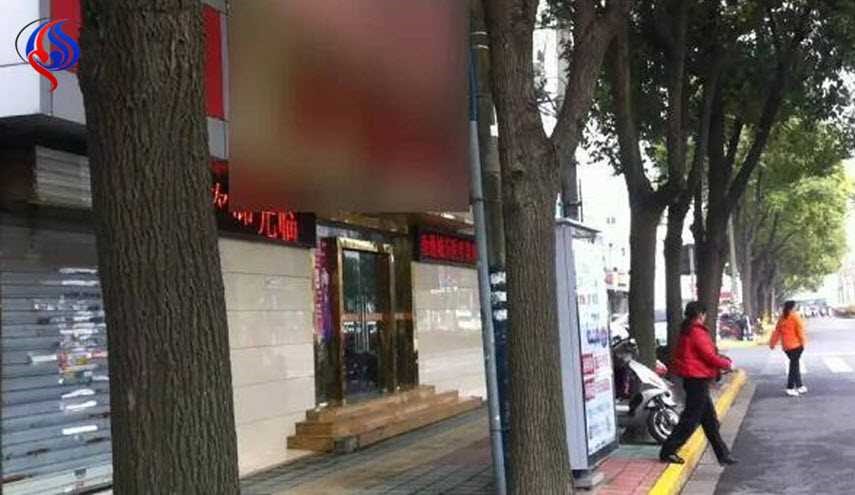 بالصور... عملية تجميل في عين سيدة تنتهي بكارثة