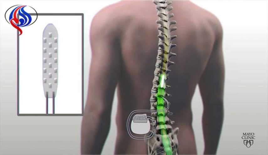 بیمار فلج نخاعی راه افتاد