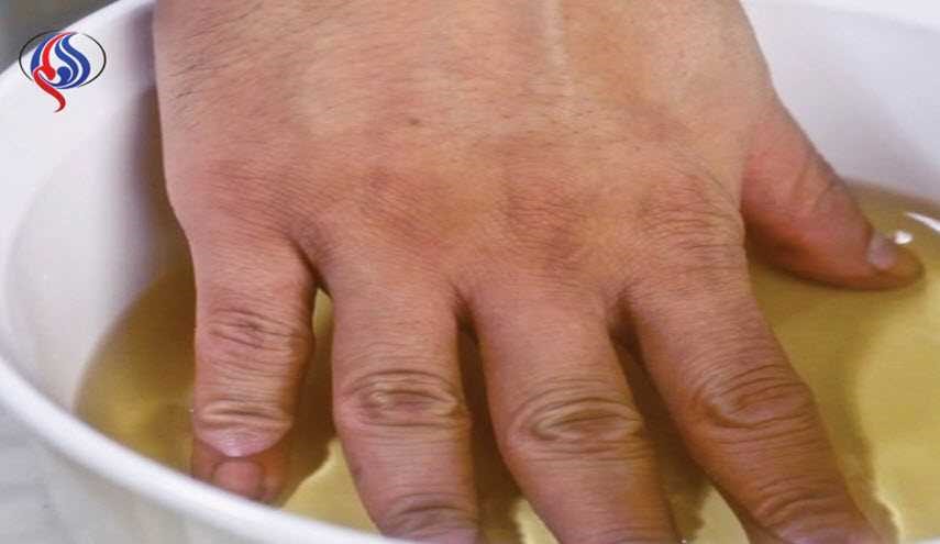 وضع يديه فى الماء والخل 3 مرات في اليوم... والنتيجة مذهلة!