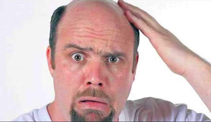 هل توجد علاجات فعّالة للصلع عند الرجال؟