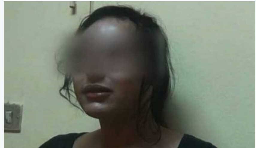مصرية تطلب الخلع .. والسبب شعر زوجها !
