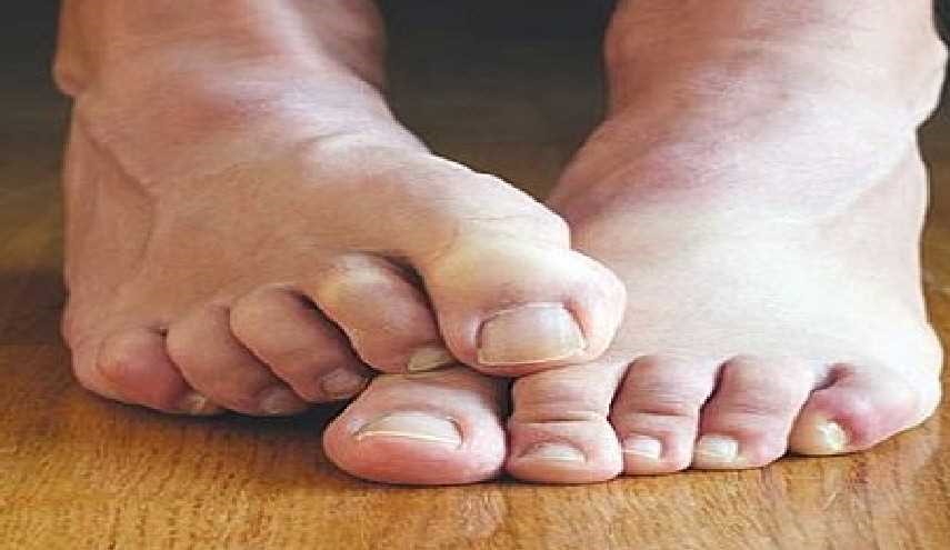 ما سبب رائحة القدمين وكيف يمكن التخلّص منها؟