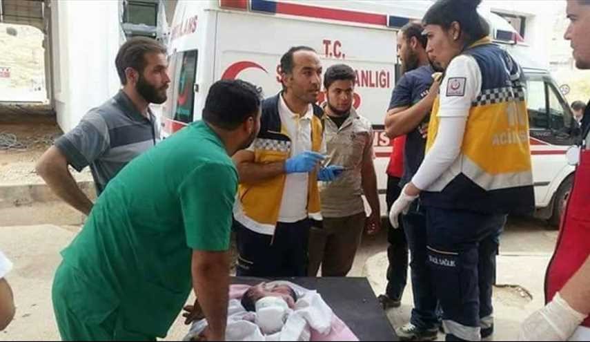 بالصور .. ولادة طفل برأسين في إدلب شمال سوريا
