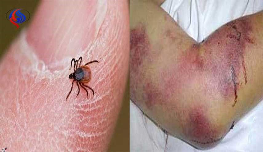 چگونگی نگهداری گوشت برای مقابله با تب کنگو