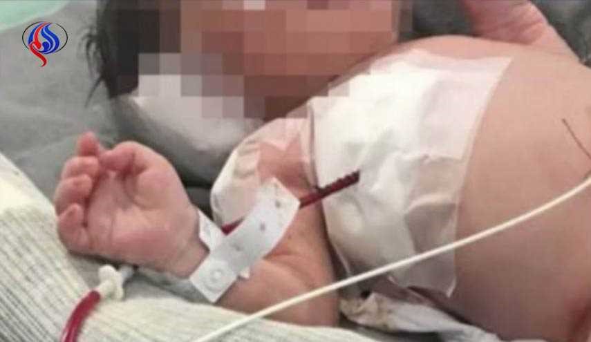جنين يتلقى رصاصة طائشة وهو في رحم والدته.. وهذا ما حدث!