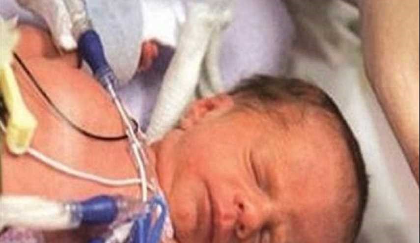 حالة نادرة.. جنين عمره 36 أسبوع أنقذ حياته وحياة والدته