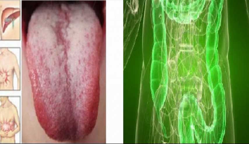 علامات تدل على أن جسمك مليء بالسموم.. تعرف عليها!