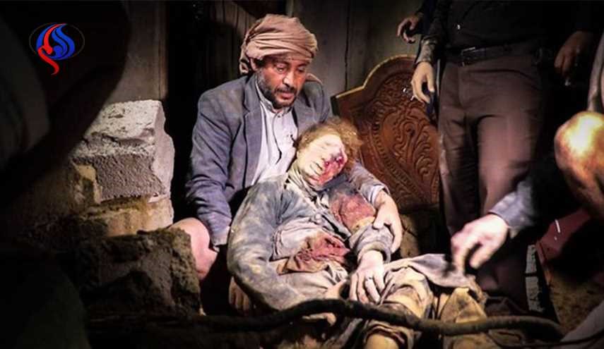 لماذا تتقاعس الأمم المتحدة عن مساعدة اليمن؟