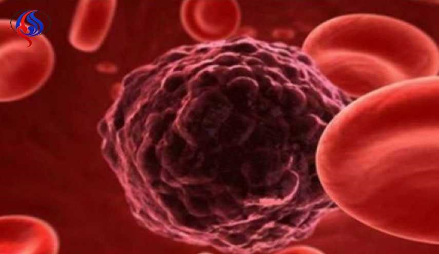 باحث سوري يكتشف دواءً جديداً  للسرطان! تعرف عليه في التفاصيل