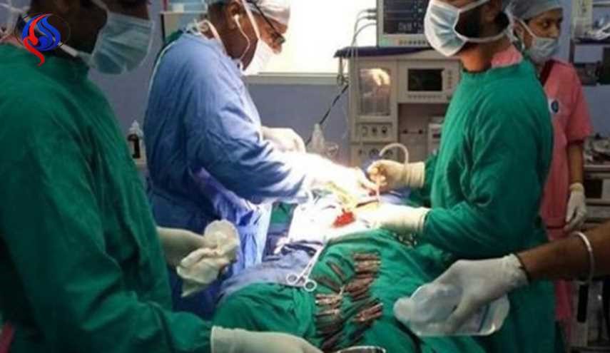 أطباء يستخرجون 40 سكينا من معدة رجل هندي!