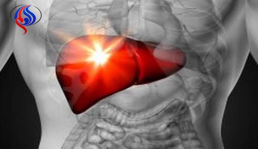 أعراض الكبد الدهنى وأسباب الإصابه به