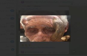 بریدن شاخ پیرمرد ۱۴۰ ساله موجب مرگش شد +فیلم