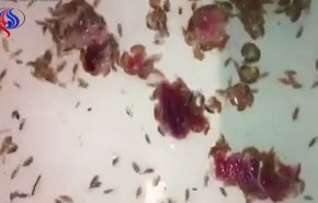 حمله موجودات ریز دریایی به پاهای نوجوان استرالیایی!