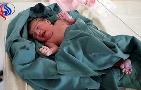افزایش شمار کودکان مبتلا به «سندروم جنین الکلی»