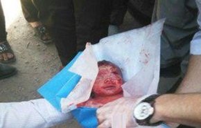 یک نوزاد رها شده به شکل وحشتناک، زنده از رودخانه‌ گرفته شد! +عکس