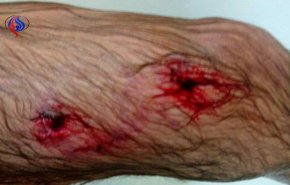 جدال چوپان با خرس وحشی/ سگ های گله ناجی شدند+ تصاویر