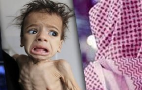 اليمن بلا عُذريّة ومفاتن و3 ملايين للعذراء الأمريكيّة!