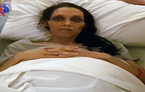 صورة مؤثرة لشابة على فراش الموت... والعائلة تكشف المستور!