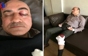 مصر.. ما هو السبب الرئيسي وراء الاعتداء على جنينة؟ 