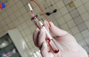 تعرف على الأمراض التي يسببها تلوث الدم والسموم بالجسم