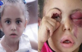 شاهد/بعد أن نجت من صواريخها.. السعودية تحتجز 