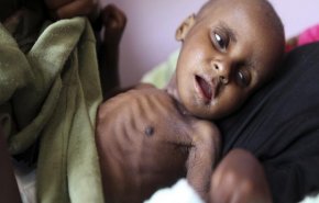سازمان ملل: یمن بدترین شرایط انسانی روی زمین را دارد