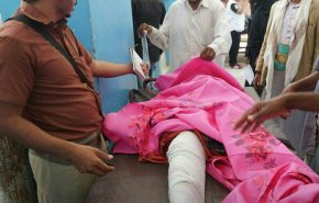 صور مؤلمة لمجزرة للعدوان السعودي بحجة +18