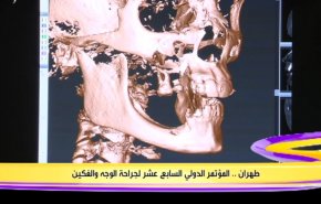 ايران تتبوأ مكانة لائقة بجراحة الفك والوجه وشكلت الملاذ الآمن