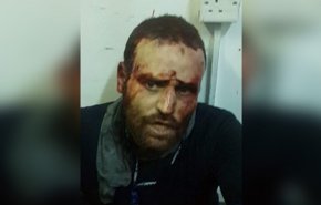 ماذا يعني حجز قضية 